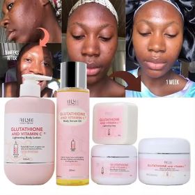 AILKE Vitamin C Cream, Hydration & Brightening Lotion, Improve Dull Skin, Clean Skin, Glowing Beauty Face & Body Care (Color: 5 in 1 Set)